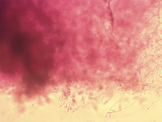 Penicillium Slides - Penicillium 01 200X